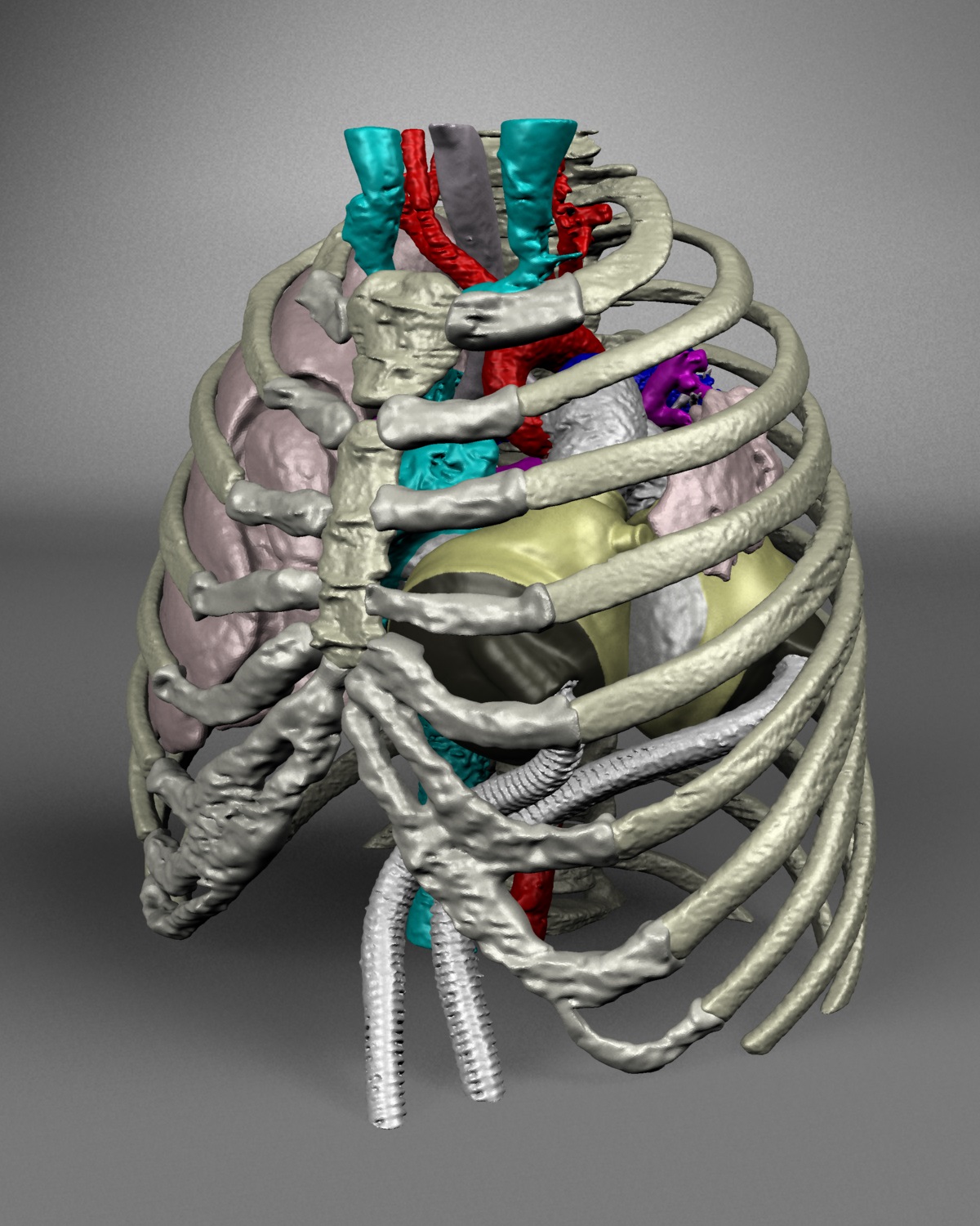 Virtual artificial heart implantation project earns tech competition award