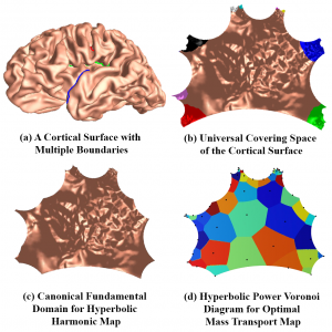 brain imaging